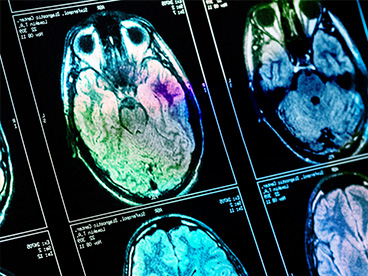 Neurologie. Polyclinique Farah